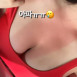 가슴골 살이 너무 타서 아프다는 누나